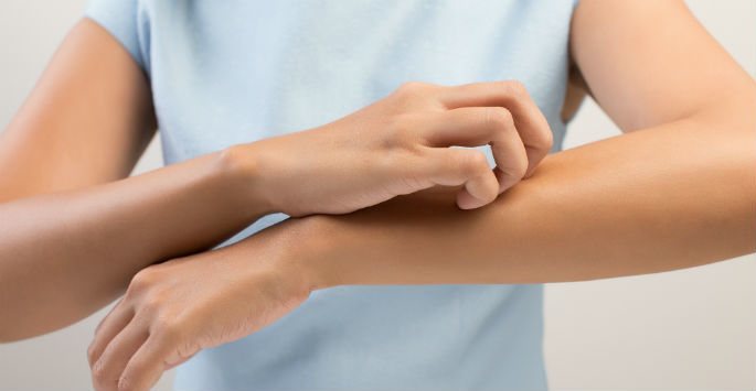 Photo of a woman in plae blue blouse and scratching her arm