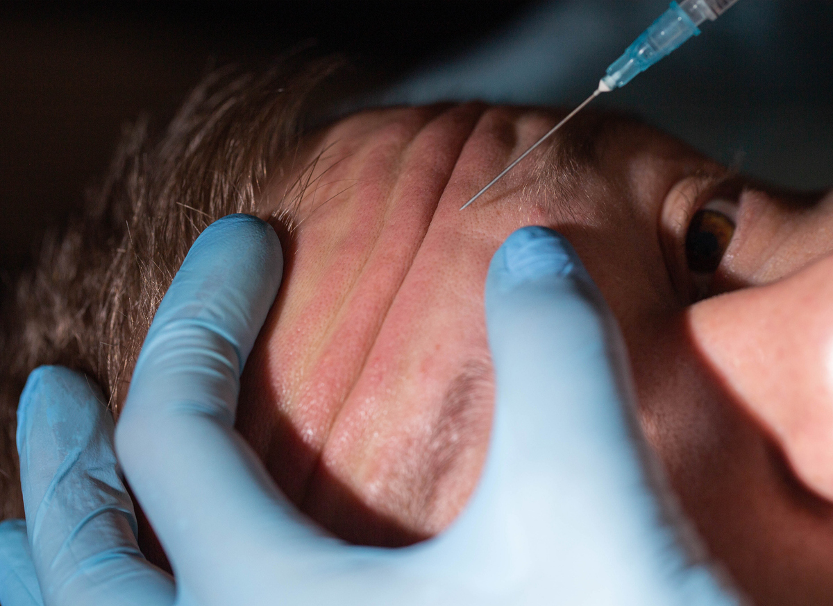 Doctor cosmetologist makes anti-aging injections into the forehead of a man against wrinkles. Close-up