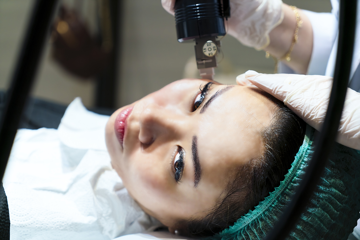 Woman having Intracel radiofrequency microneedling treatment