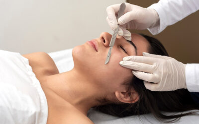 What Is Dermaplaning?