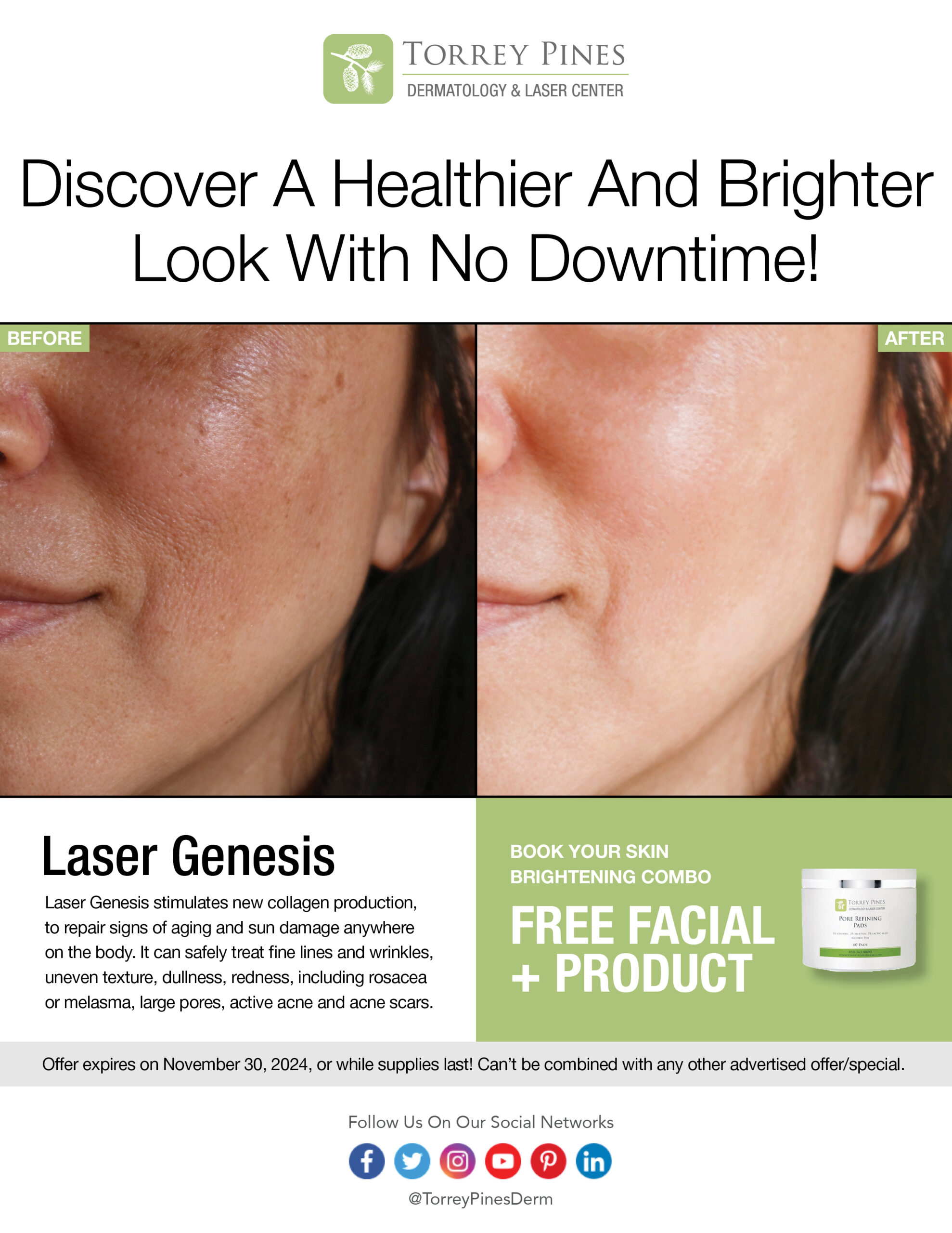 TorreyPinesDerm-Genesis-Flyer Laser-Genesis